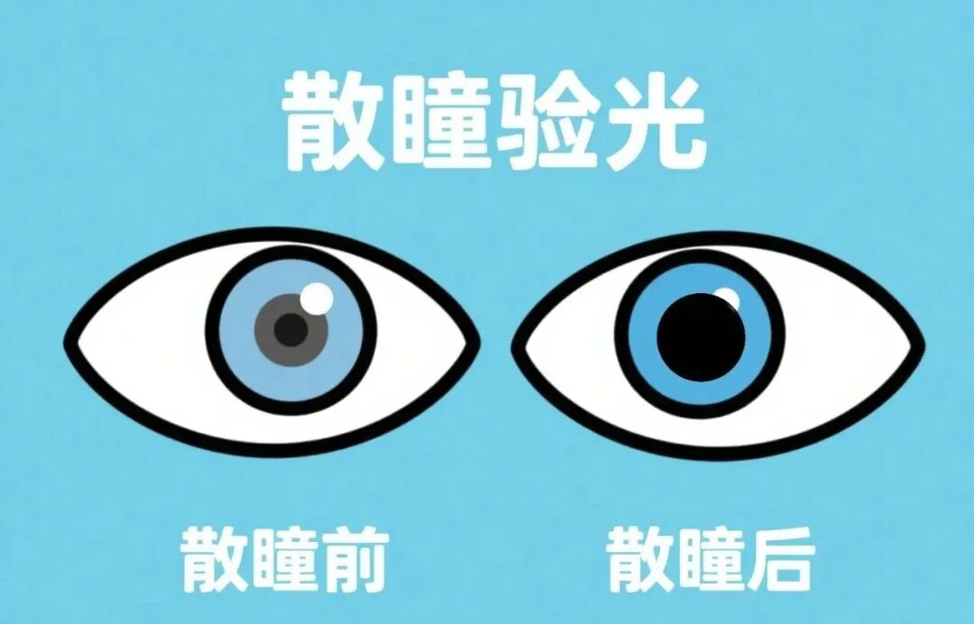 散瞳验光.jpg