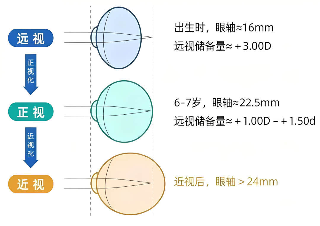 眼轴.png